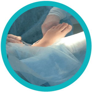 cirugía del pie